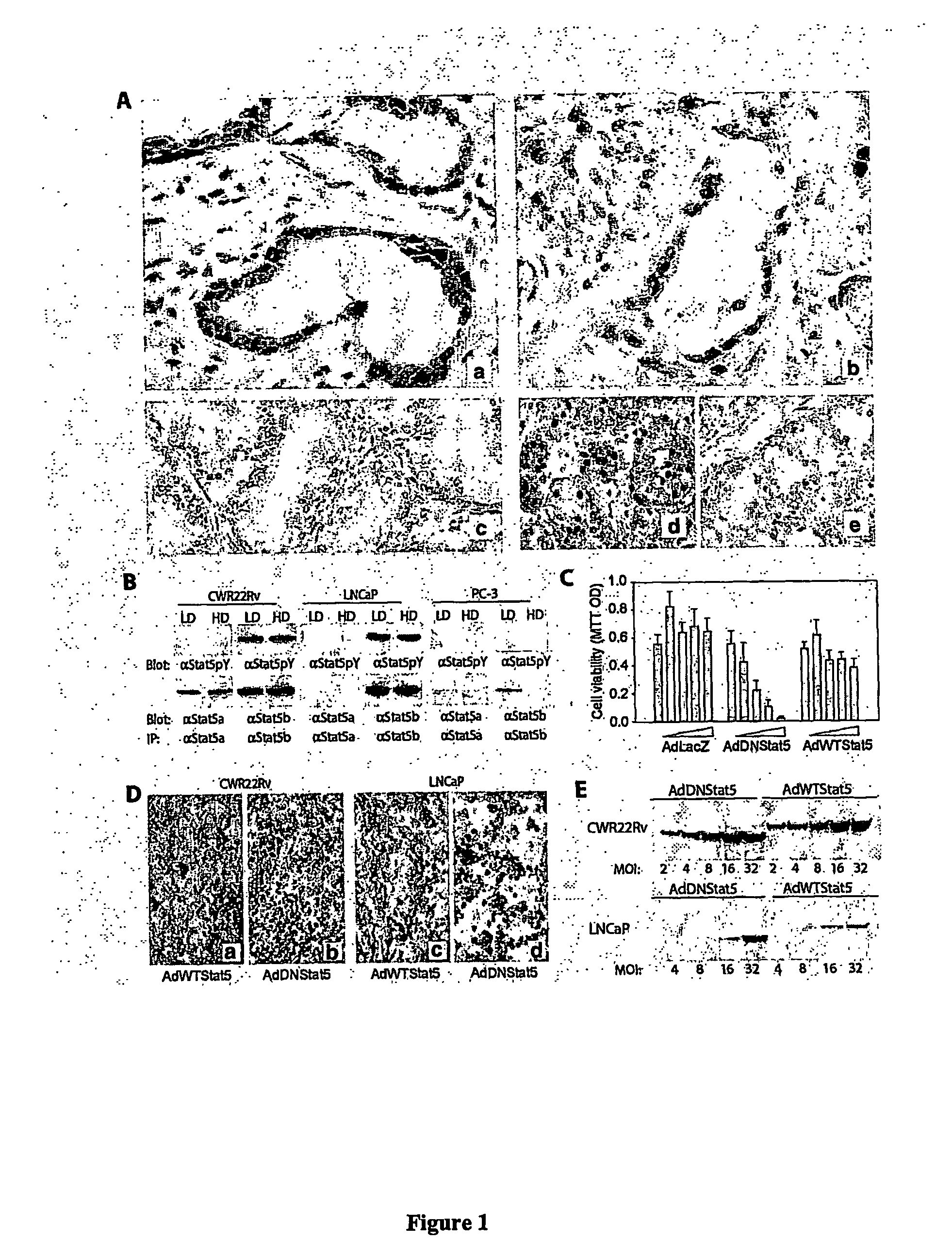 Methods and compositions for the inhibition of stat5 in prostate cancer cells