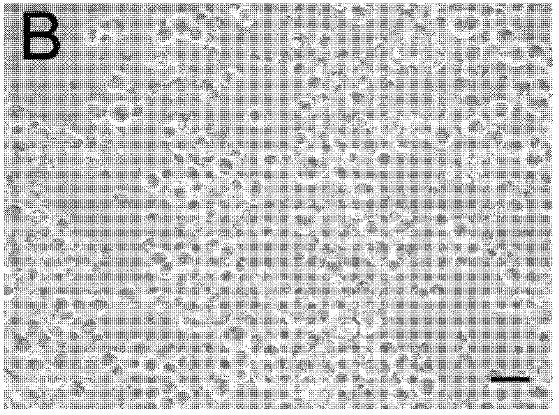 Method for separating human spermatogonial stem cells