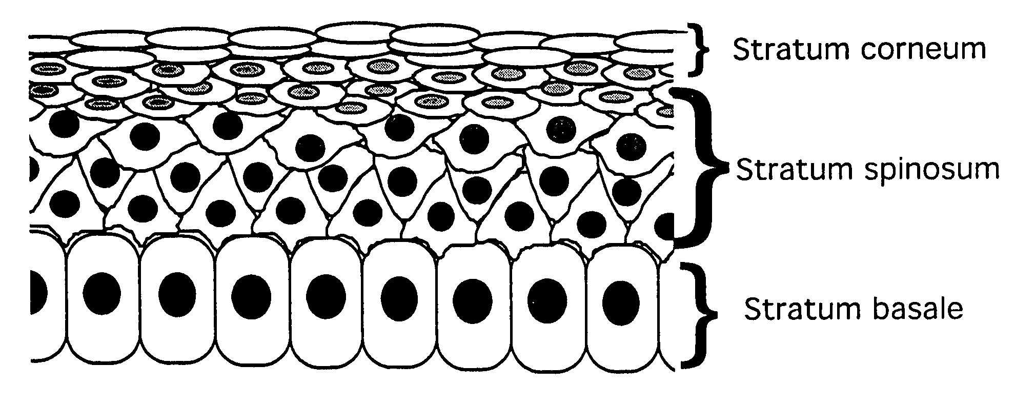 Compositions and methods for treating skin conditions