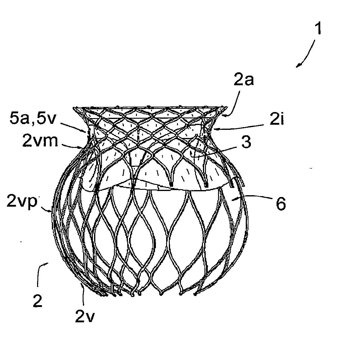 Prosthetic mitral or tricuspid heart valve