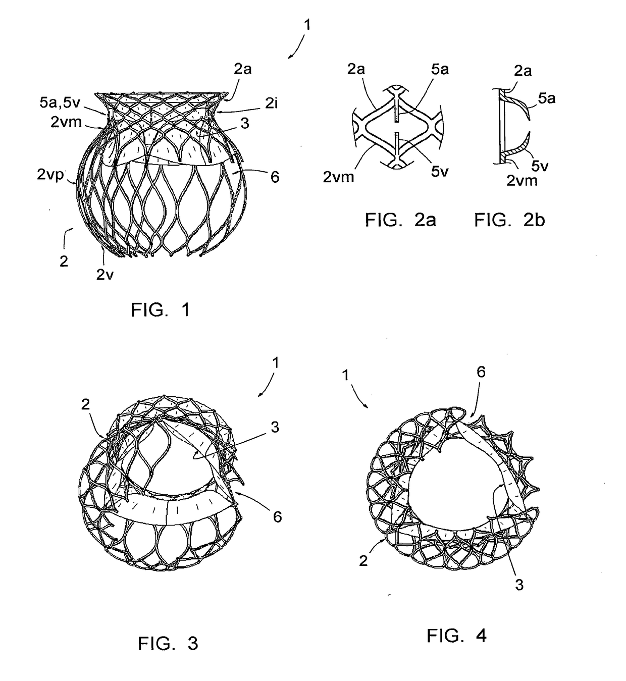 Prosthetic mitral or tricuspid heart valve