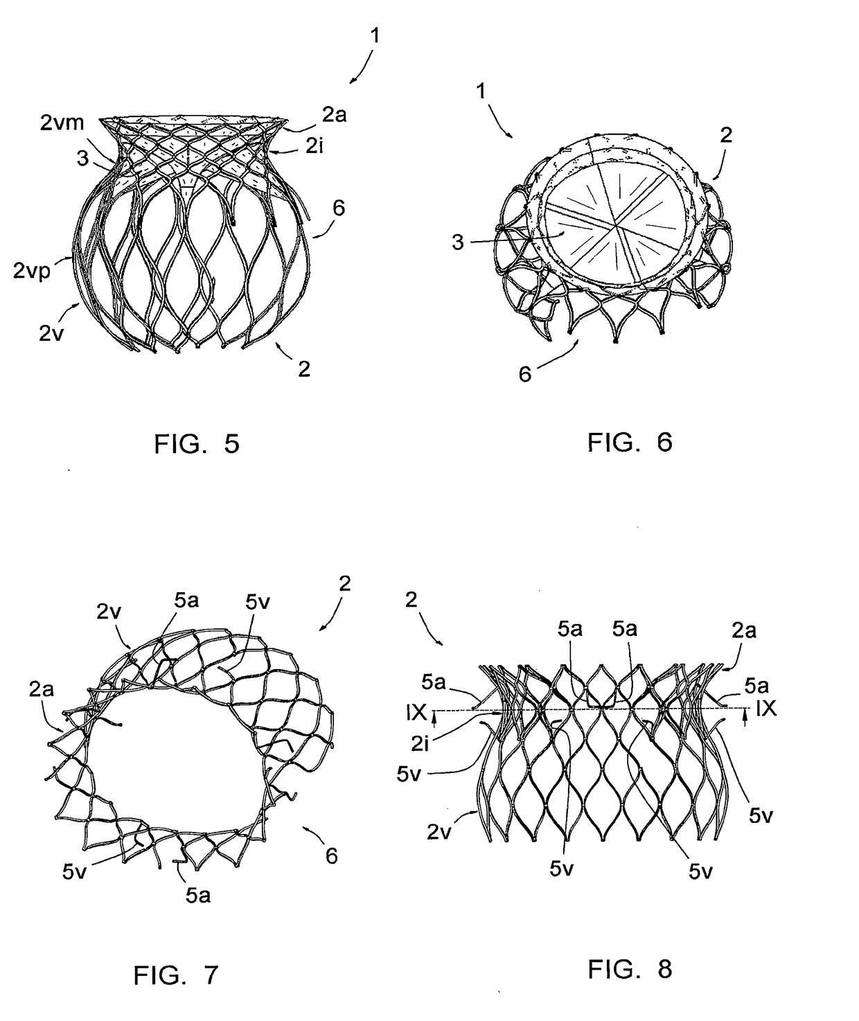 Prosthetic mitral or tricuspid heart valve