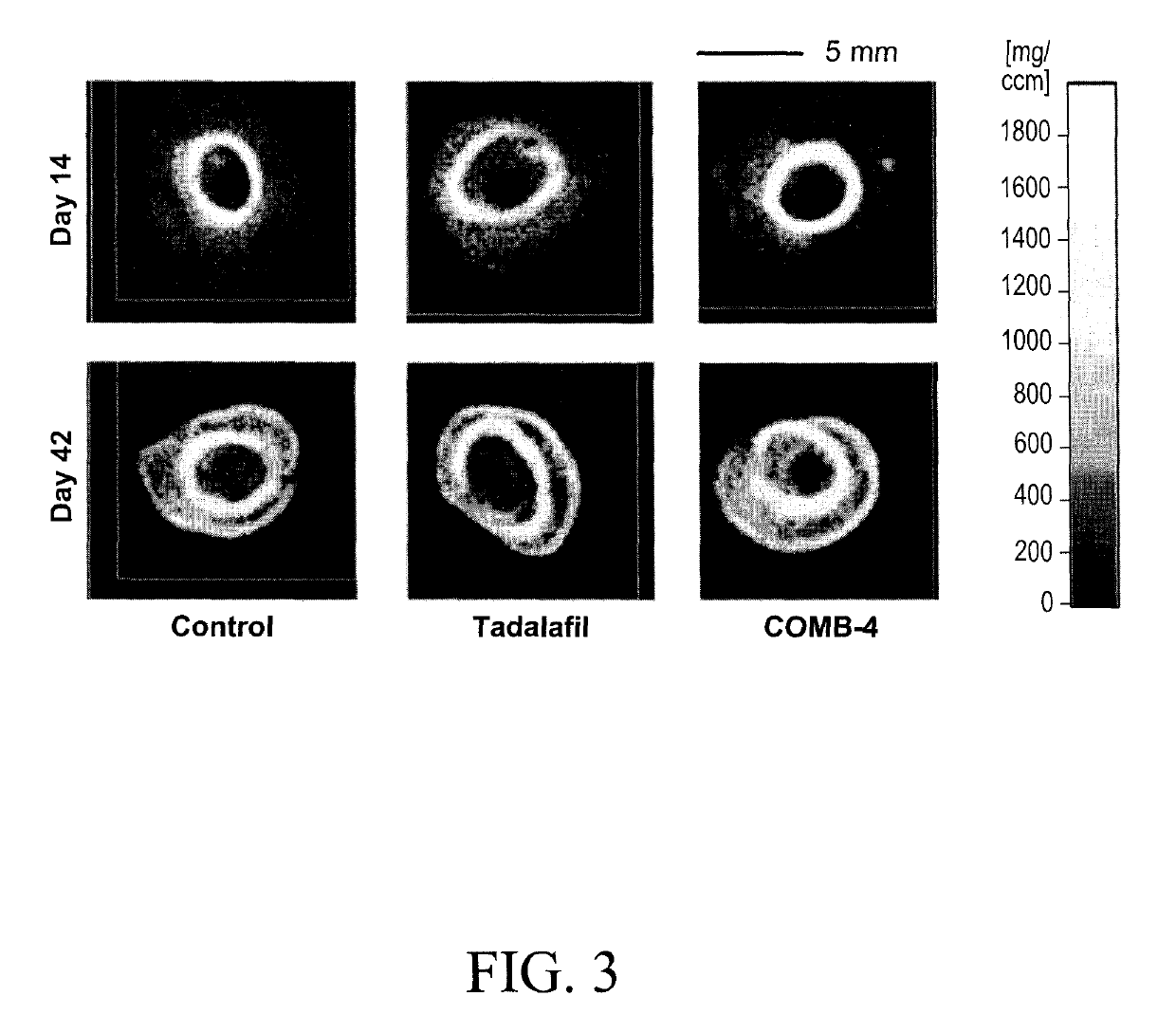 Compositions and methods for the treatment of orthopedic ailments