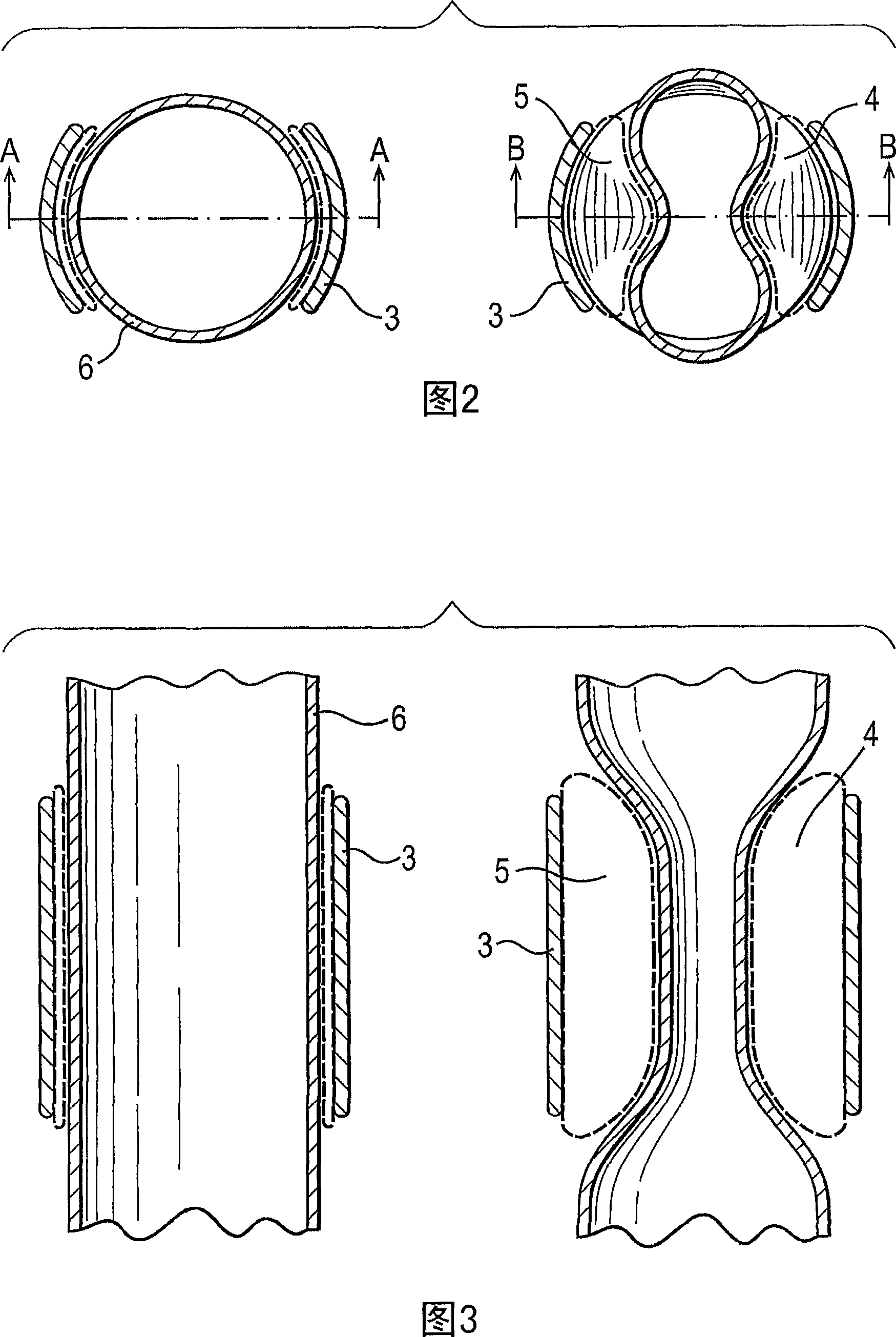 A blood circulation assistance device