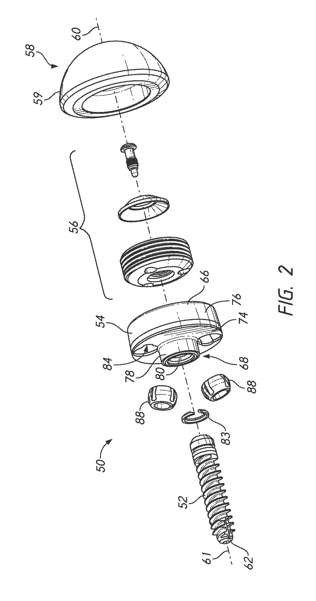 Guides and instruments for improving accuracy of glenoid implant placement