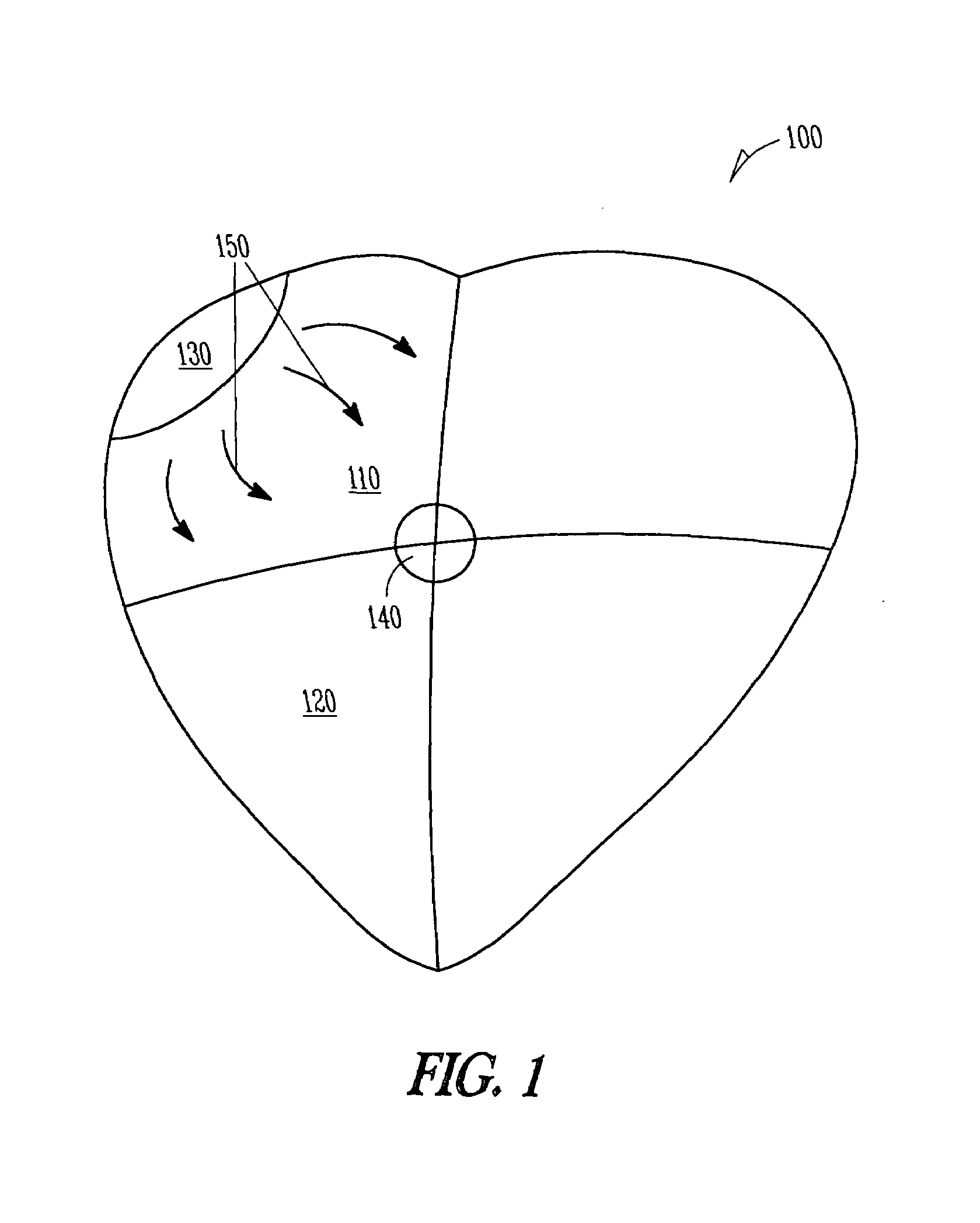 System and method for classifying tachycardia arrhythmias having 1:1 atrial-to-ventricular rhythms