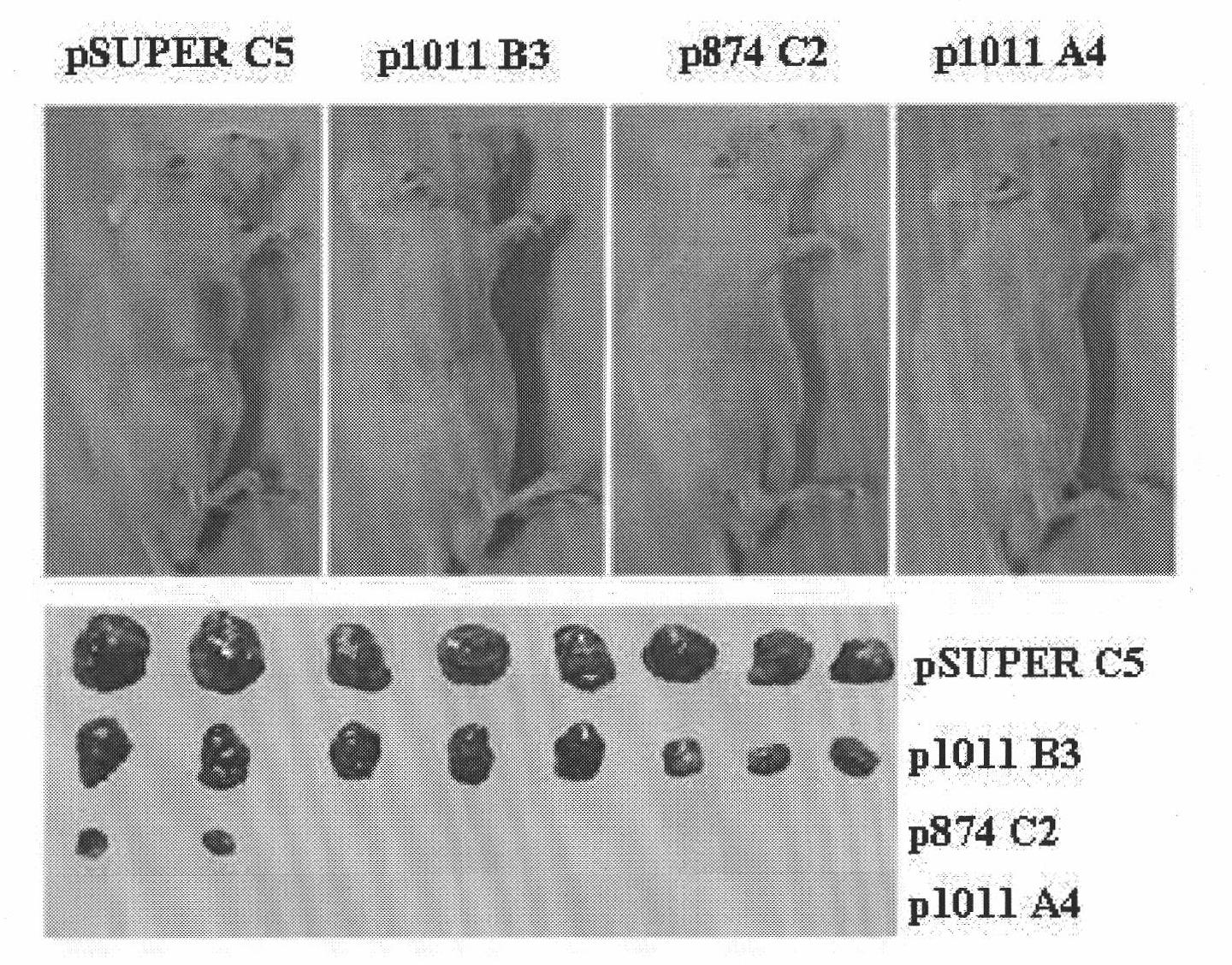 Ribonucleic acid taking liver cancer related gene DLK1 as target spot and application thereof