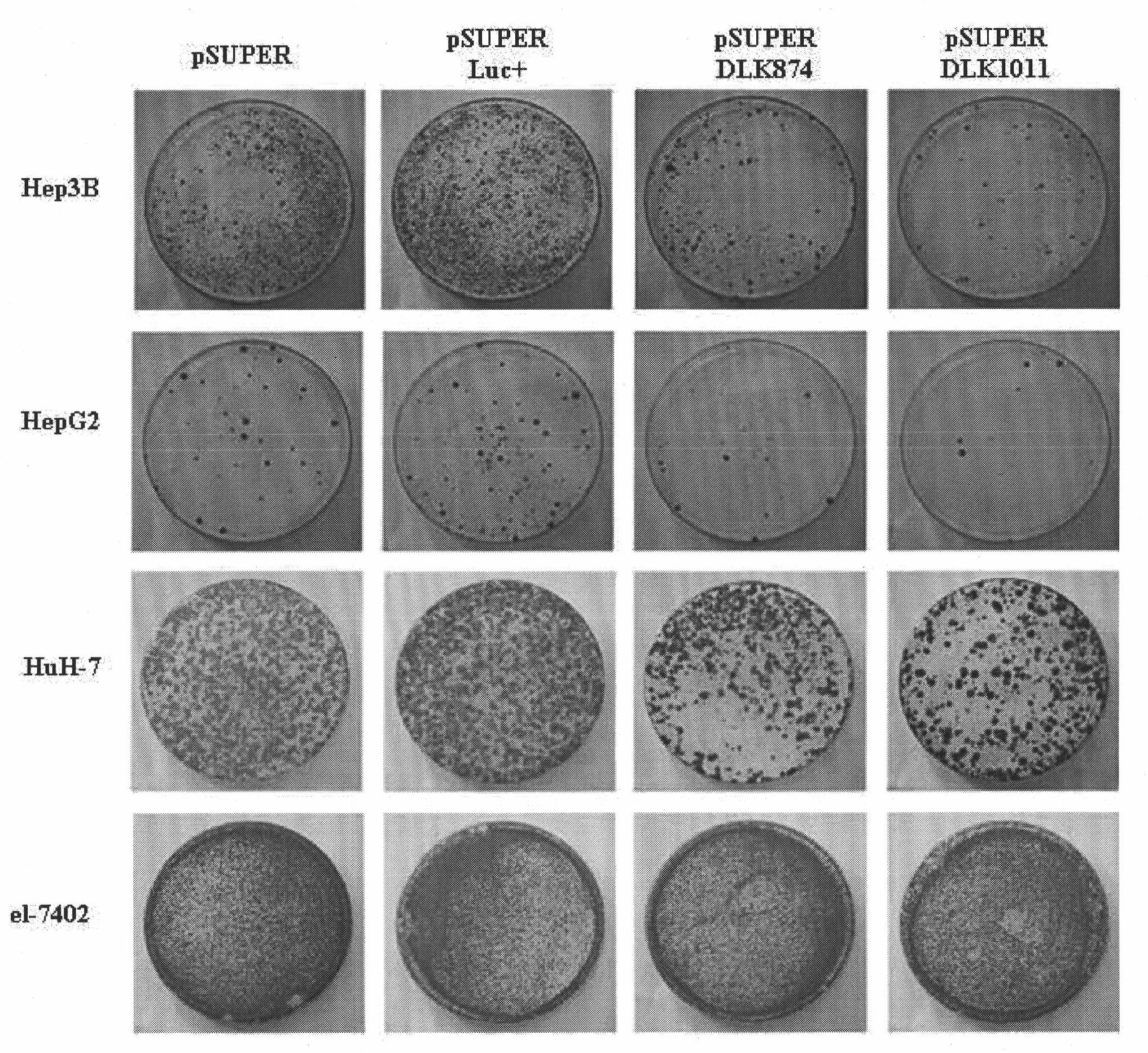 Ribonucleic acid taking liver cancer related gene DLK1 as target spot and application thereof