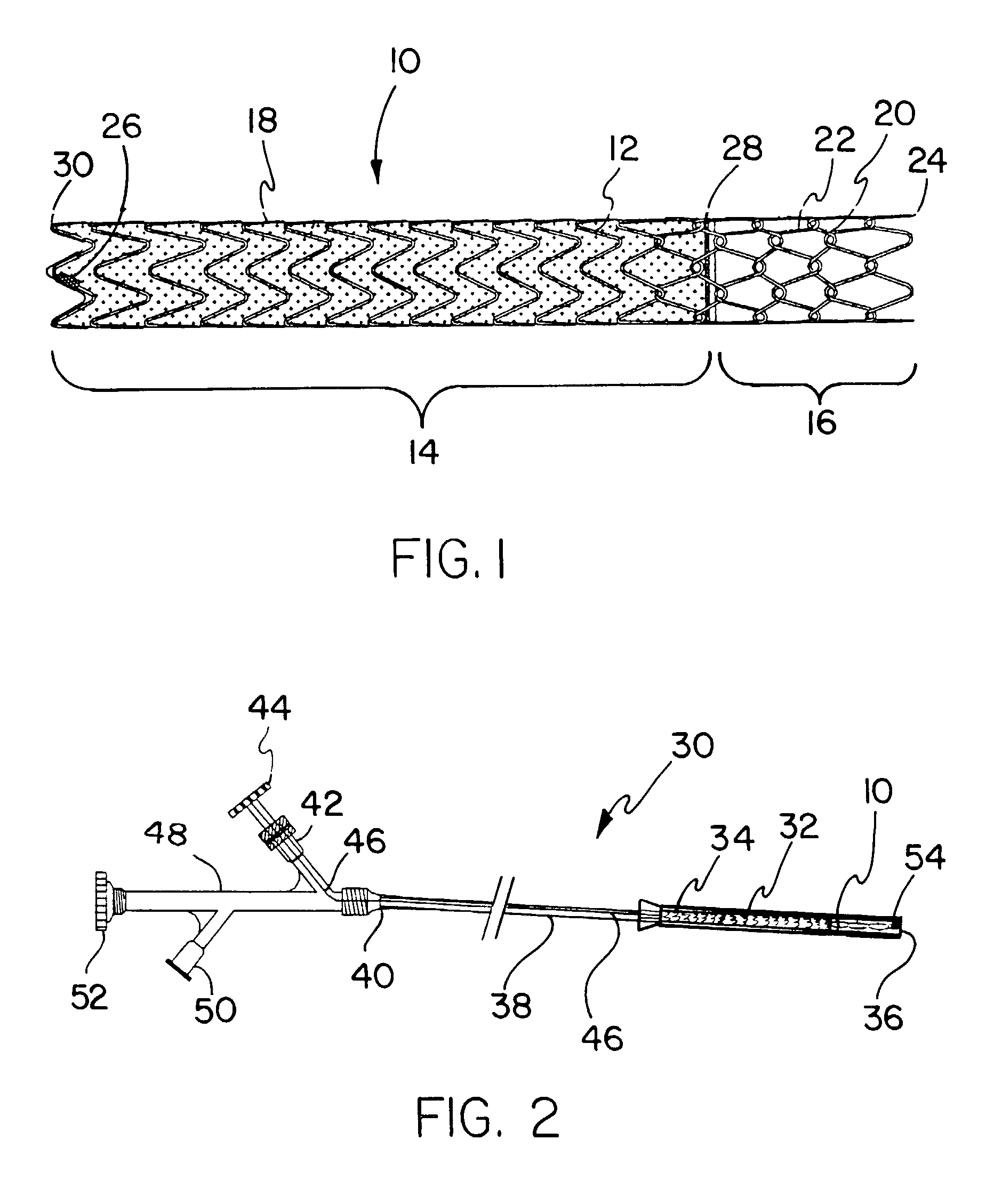 Covered endoprosthesis and delivery system