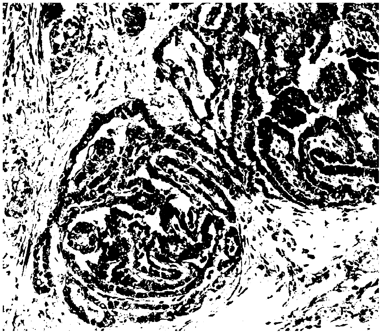 Hematoxylin dye solution for quick frozen sections used in linear dyeing instrument and dyeing method