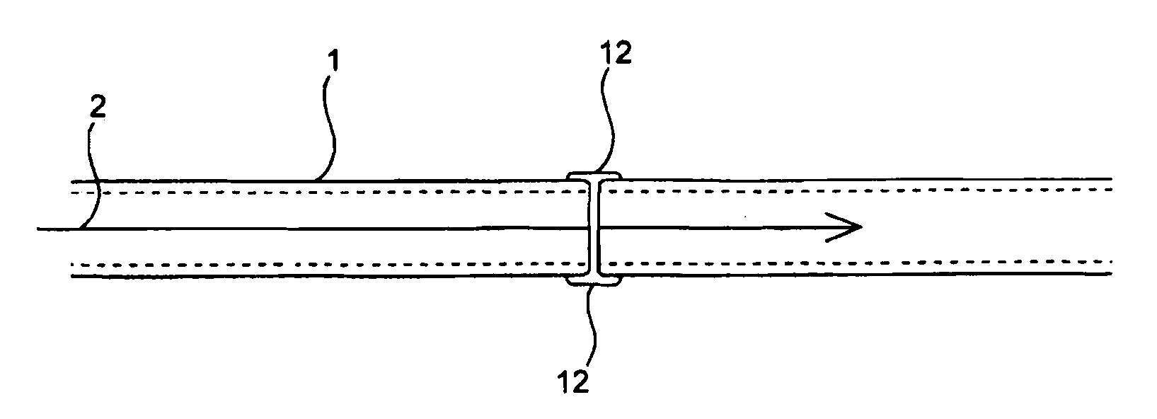 Compositions and methods for joining non-conjoined lumens