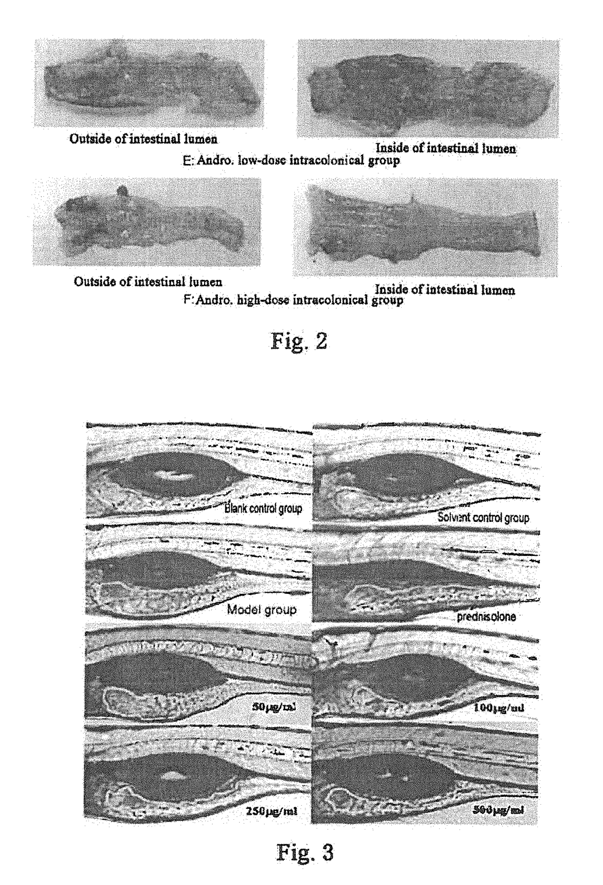 Application of andrographolide in the preparation of a pharmaceutical for treatment of inflammatory bowel disease, andrographolide enteric targeting micropellet, and method for preparation thereof