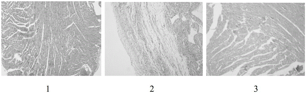 Traditional Chinese medicine composition for preventing and treating cardiac muscle fibers or myocardial hypertrophy