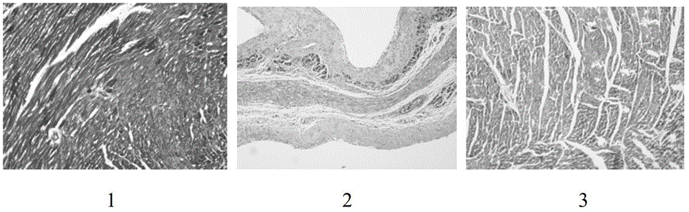 Traditional Chinese medicine composition for preventing and treating cardiac muscle fibers or myocardial hypertrophy