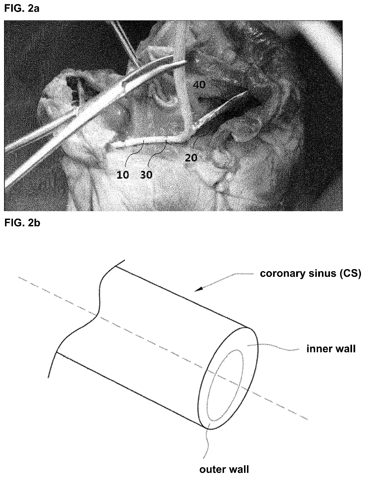 Cerclage operation device provided with position fixing device