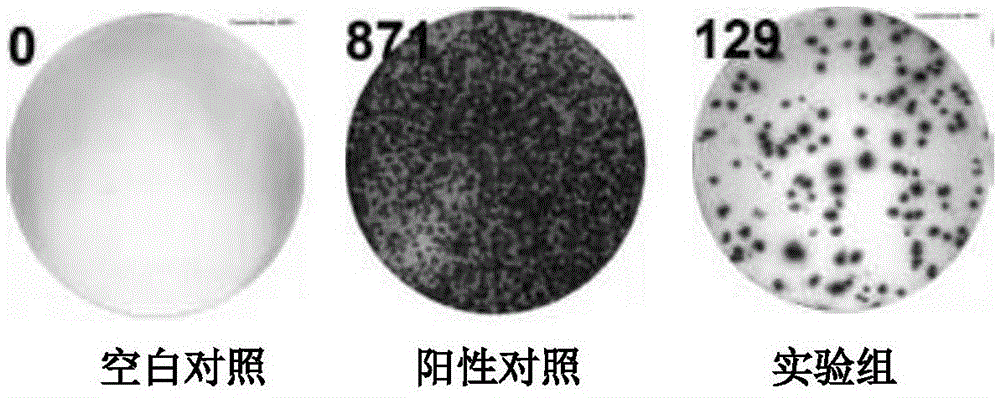 Mycobacterium tuberculosis fusion protein and application thereof in induction of peripheral blood mononuclear cells to generate cytokines