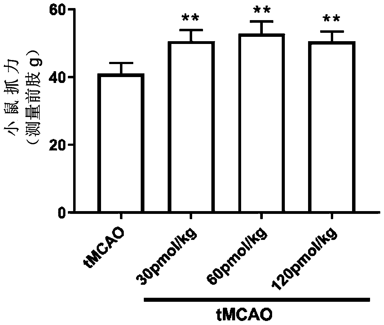 Application of compound Axitinib in preparation of medicine for treating cerebrovascular diseases and pharmaceutical composition thereof