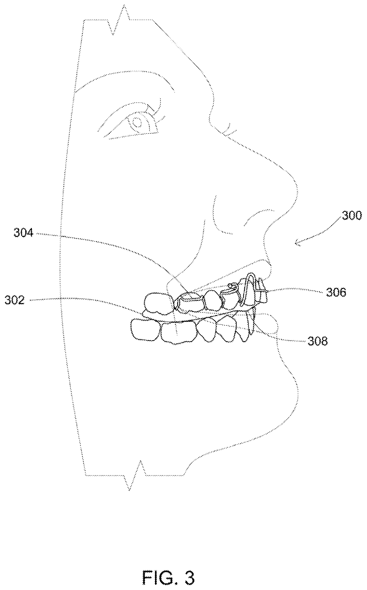 Orthopedic appliance