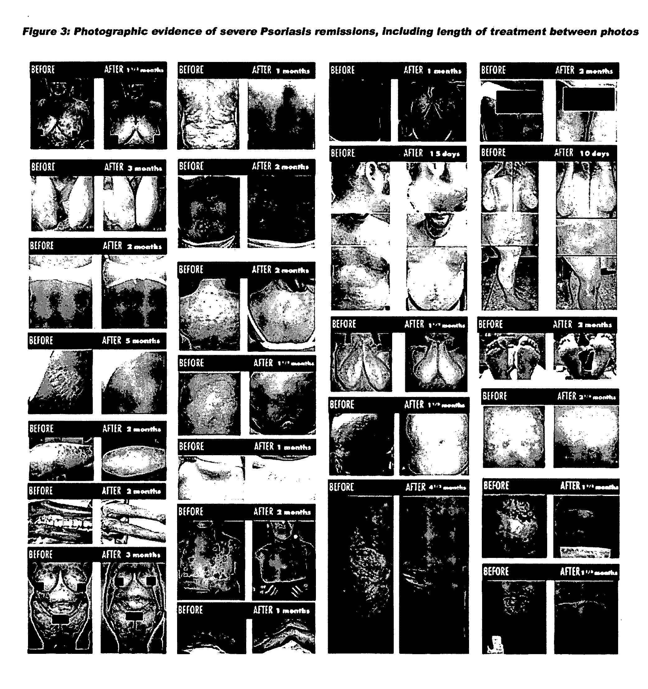 Synergistic phytoceutical compositions