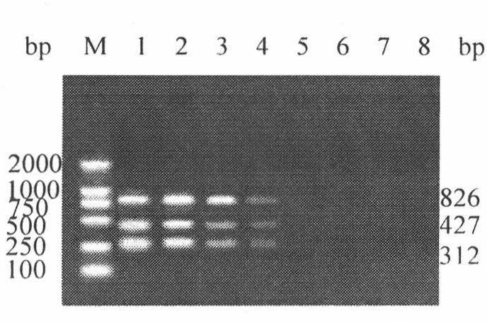 h5, h7, h9 subtype avian influenza virus detection kit