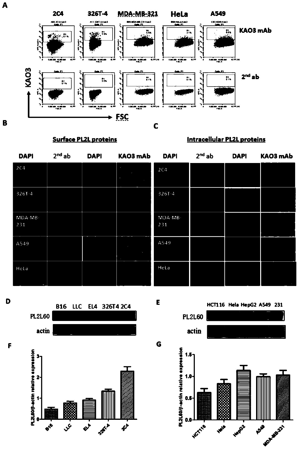 Application of Anti-pl2l60 Protein Antibody in Preparation of Antitumor Drugs