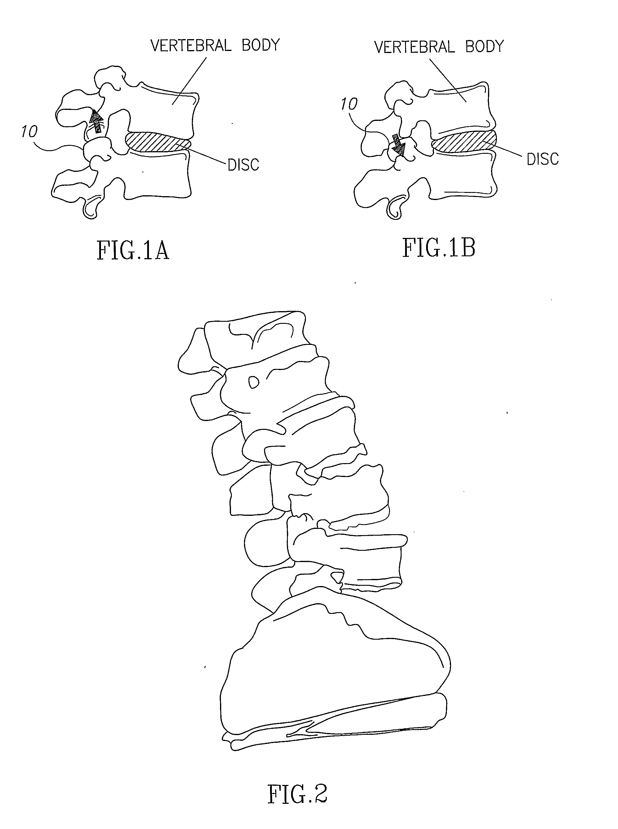 System for positioning of surgical inserts and tools