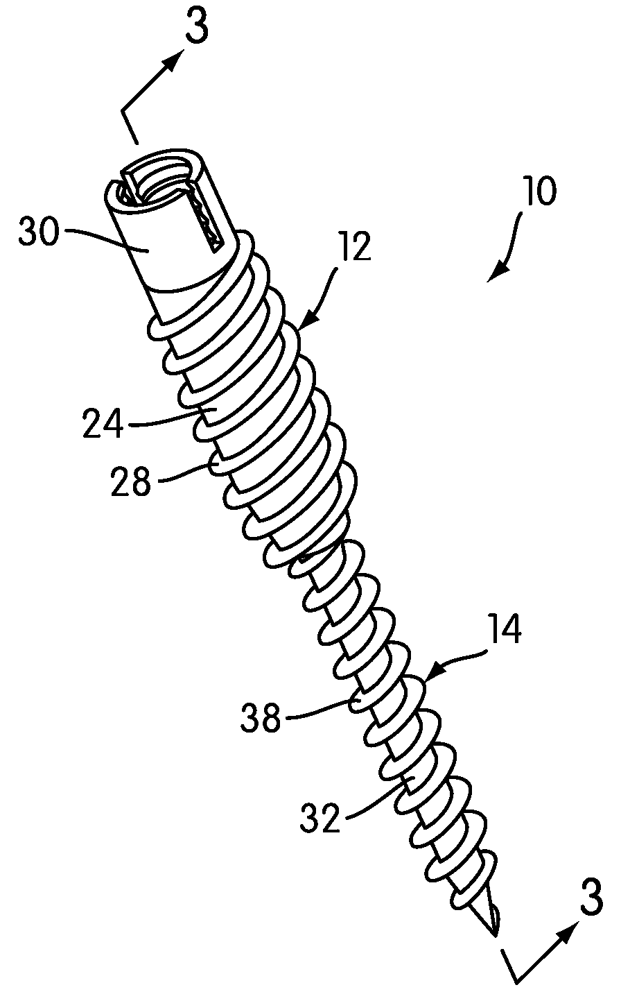 Orthopedic Screw System