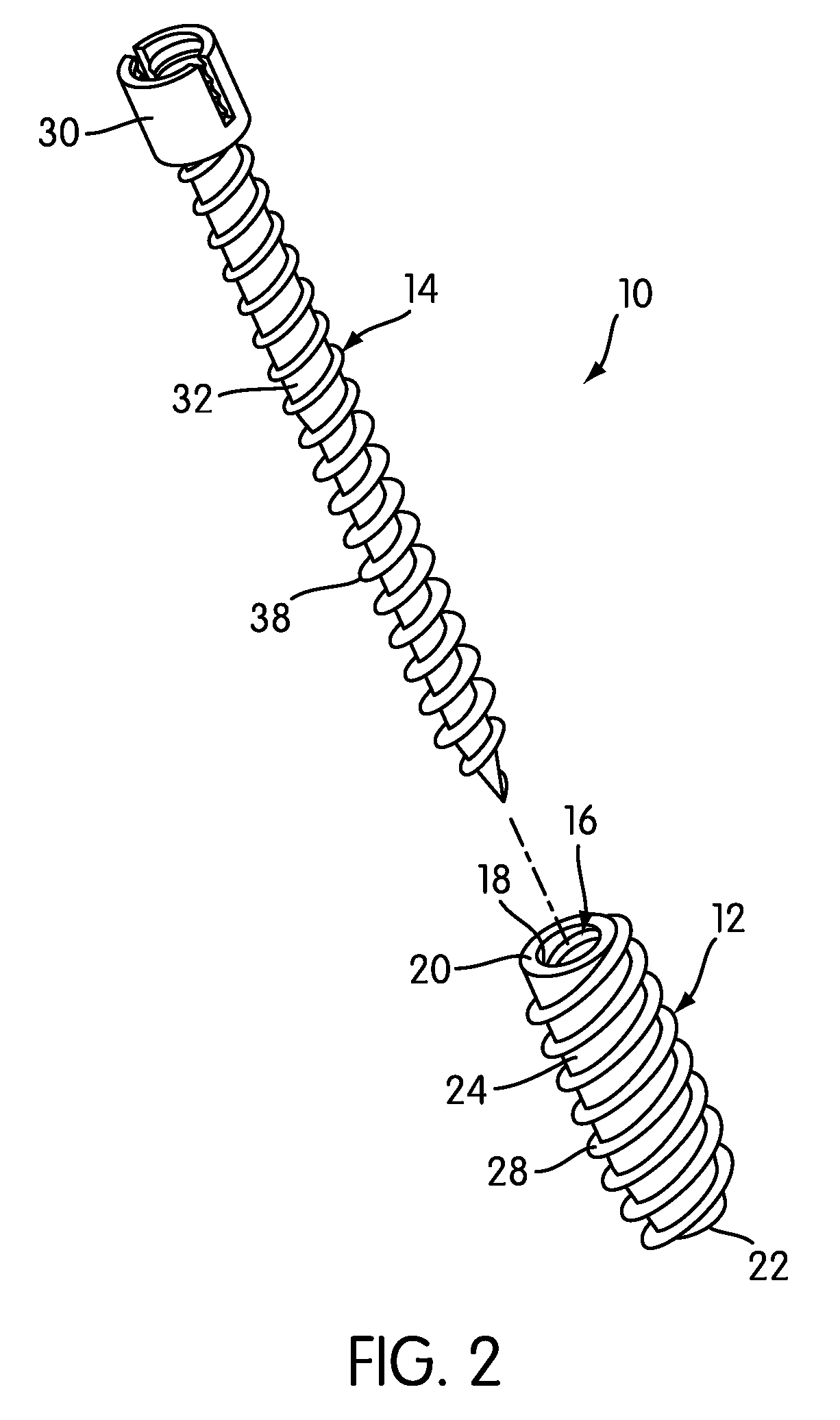 Orthopedic Screw System