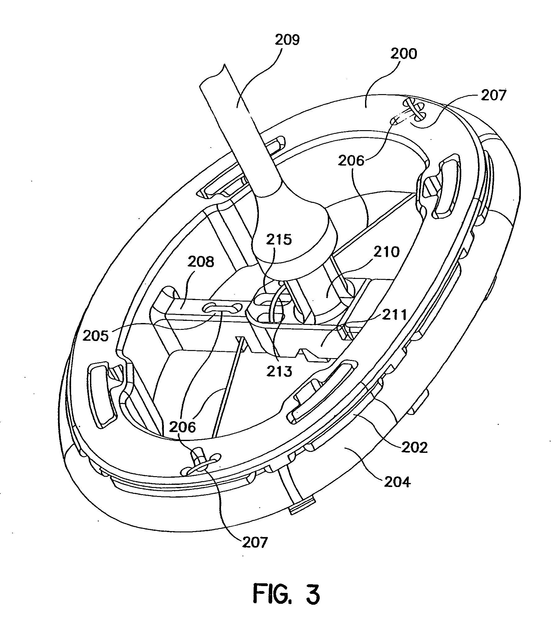 Flexible annuloplasty prosthesis and holder