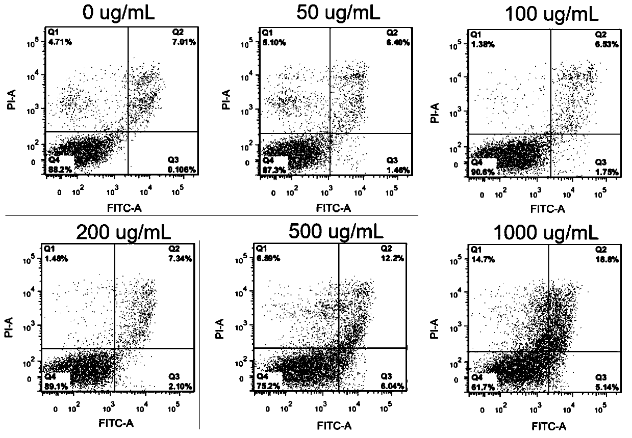 Chinese medicine composition used for treating tumor and preventing tumor relapse and metastasis and preparation method thereof