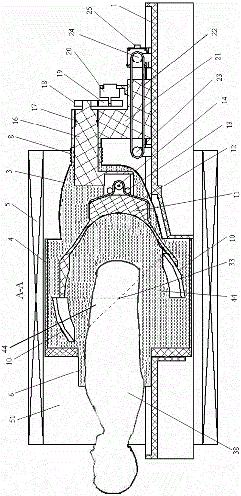 Focused Ultrasound Therapy Device