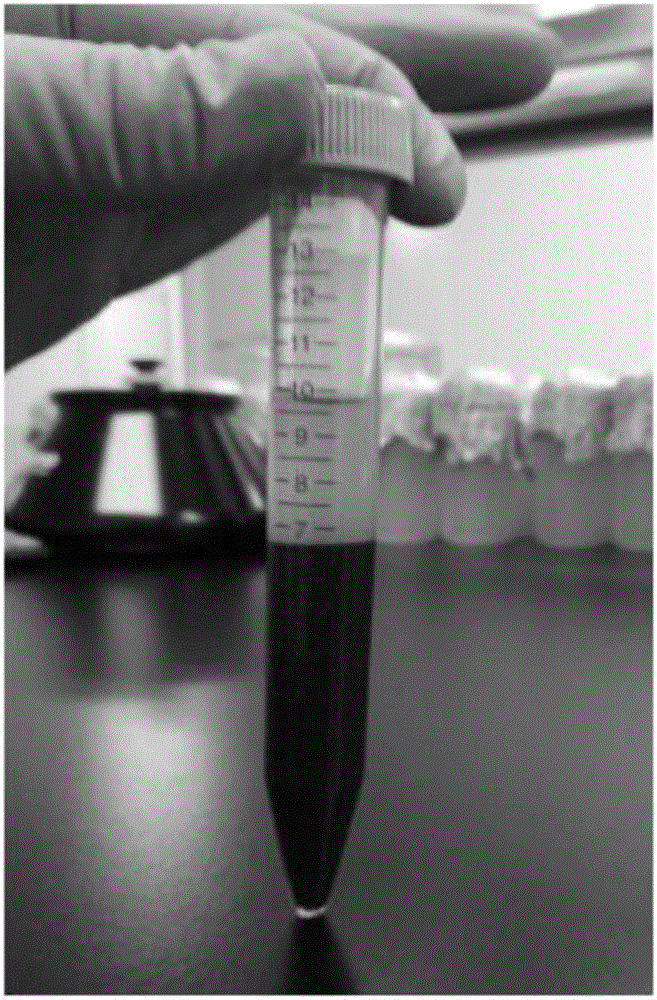 Method for preparing PRP (platelet-rich plasma) of umbilical cord blood