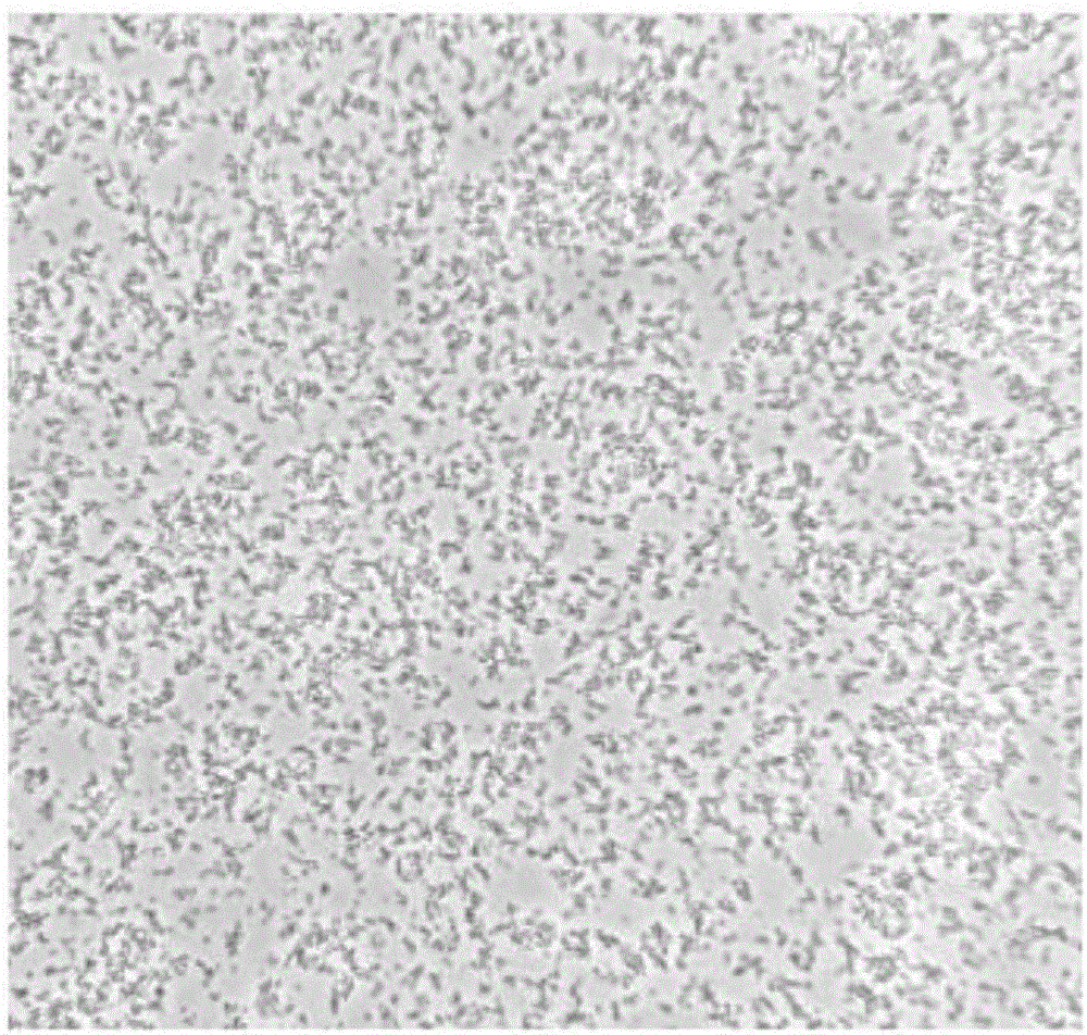 Method for preparing PRP (platelet-rich plasma) of umbilical cord blood