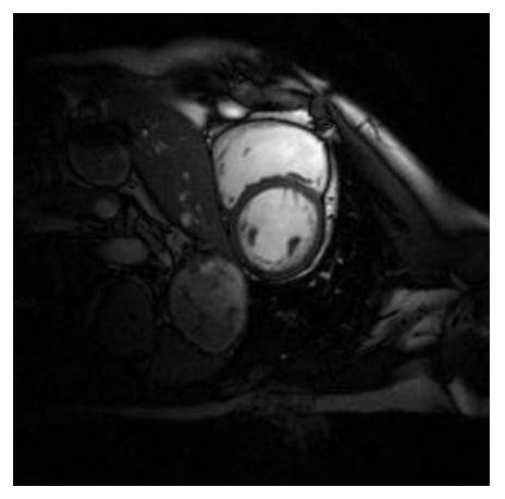 A cs-mri image reconstruction method based on non-convex constraints of ranking structure group