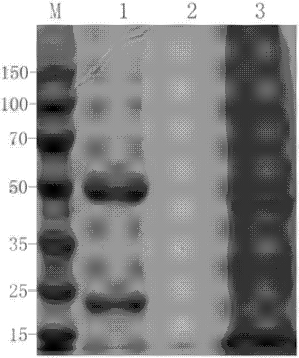 Mouse anti-human CD61 monoclonal antibody hybridoma cell line, monoclonal antibody and preparation method and application thereof and flow cytometry detection reagent