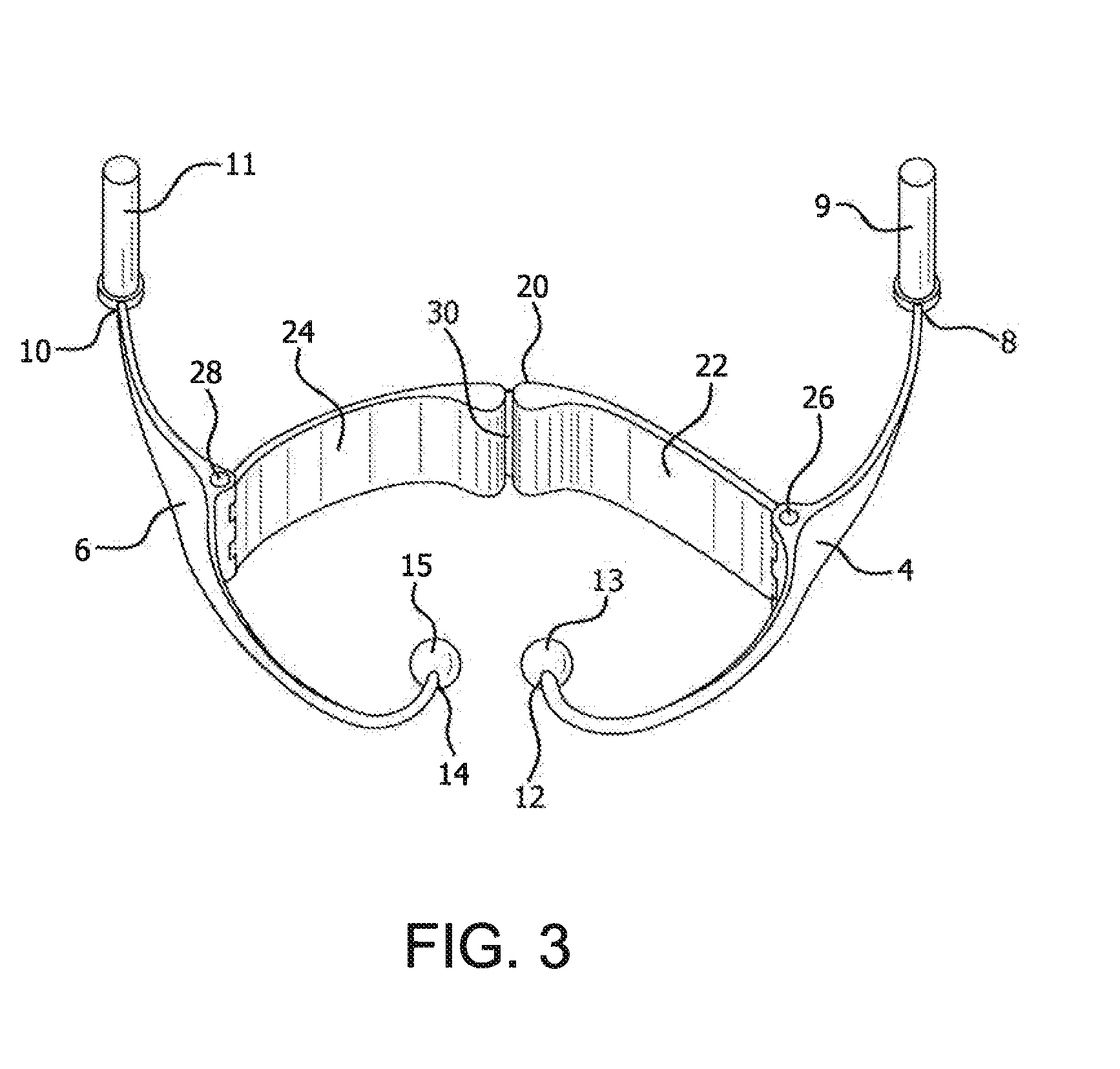 Back strengthening and therapy device