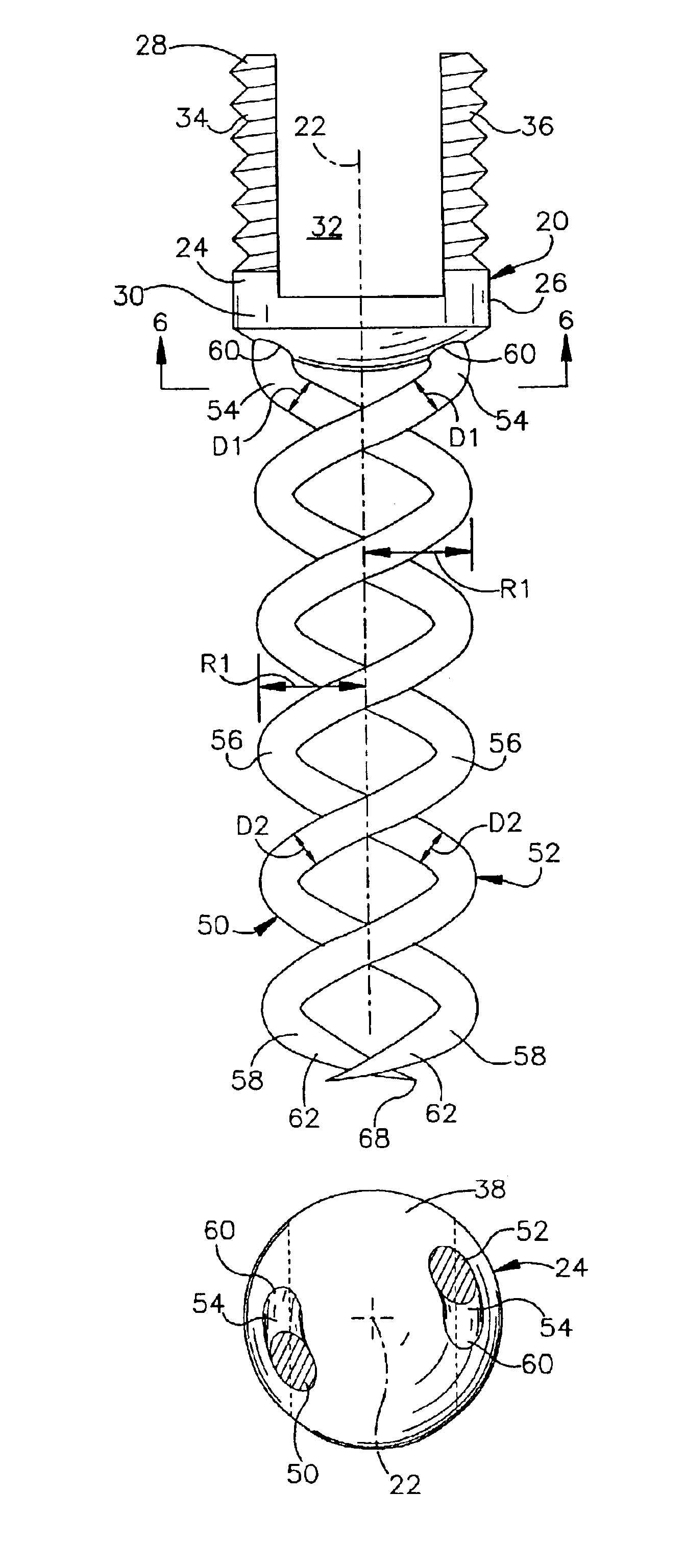 Apparatus for implantation into bone