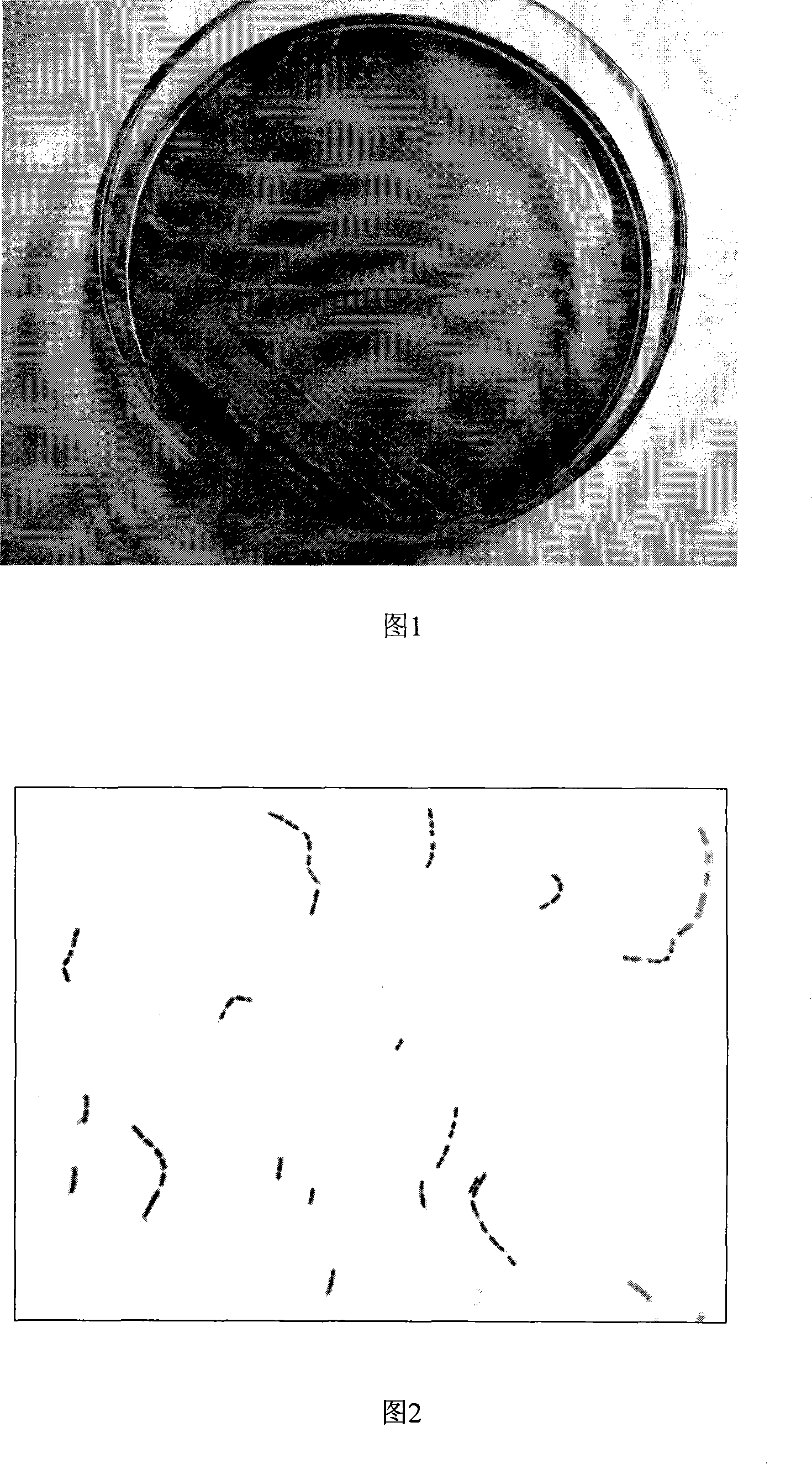 Oxidation resistant Lactobacillus casei capable of resisting hydrogen peroxide and eliminating free radical, and use thereof