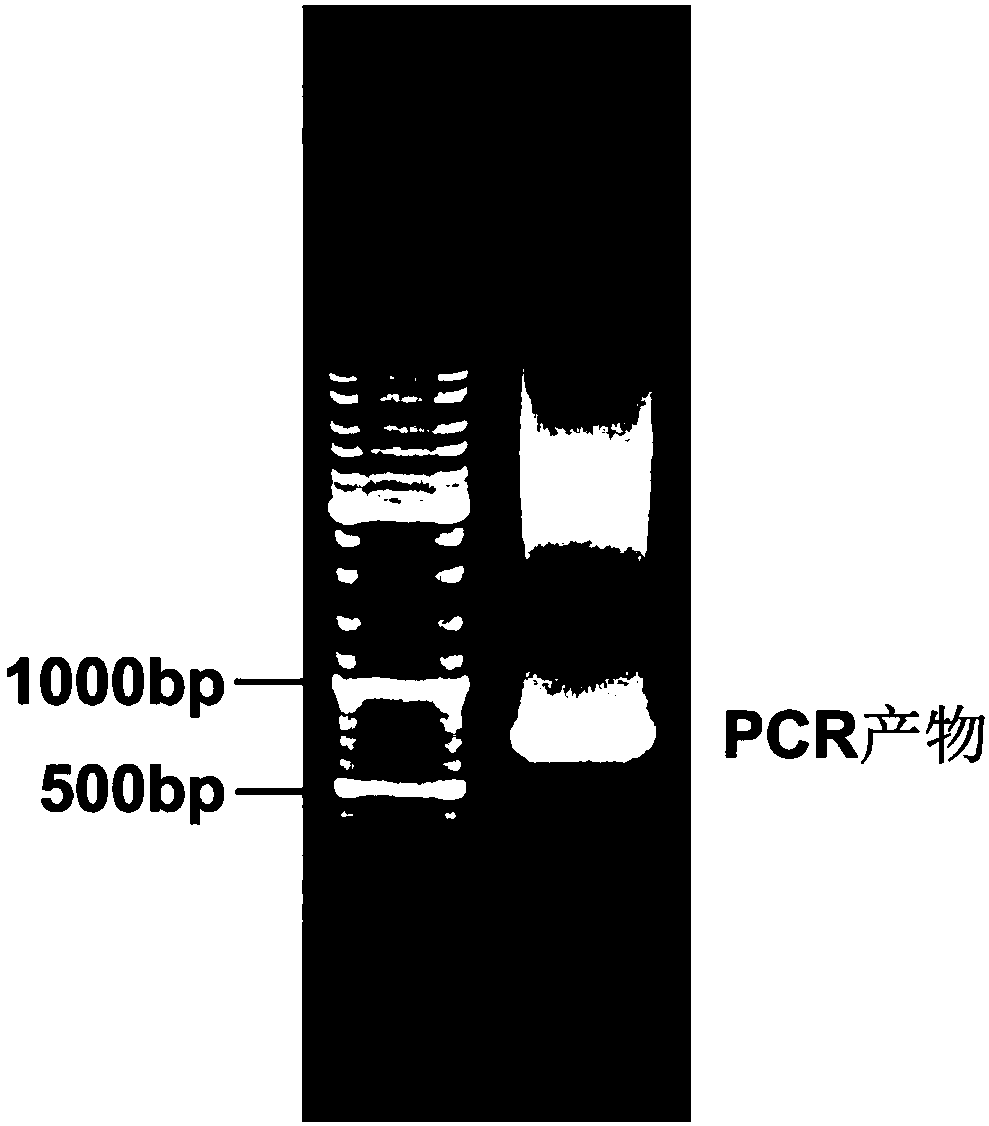 Recombinant mIL-22BP vector, and liposome complex and preparation methods and application thereof