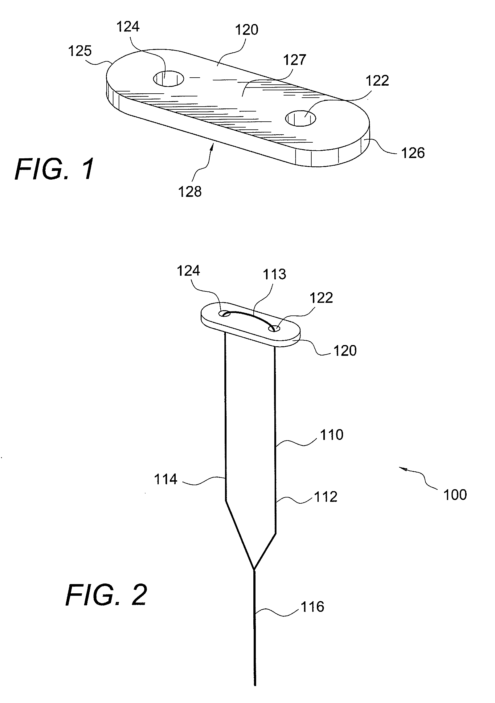 CMC repair using suture-button construct