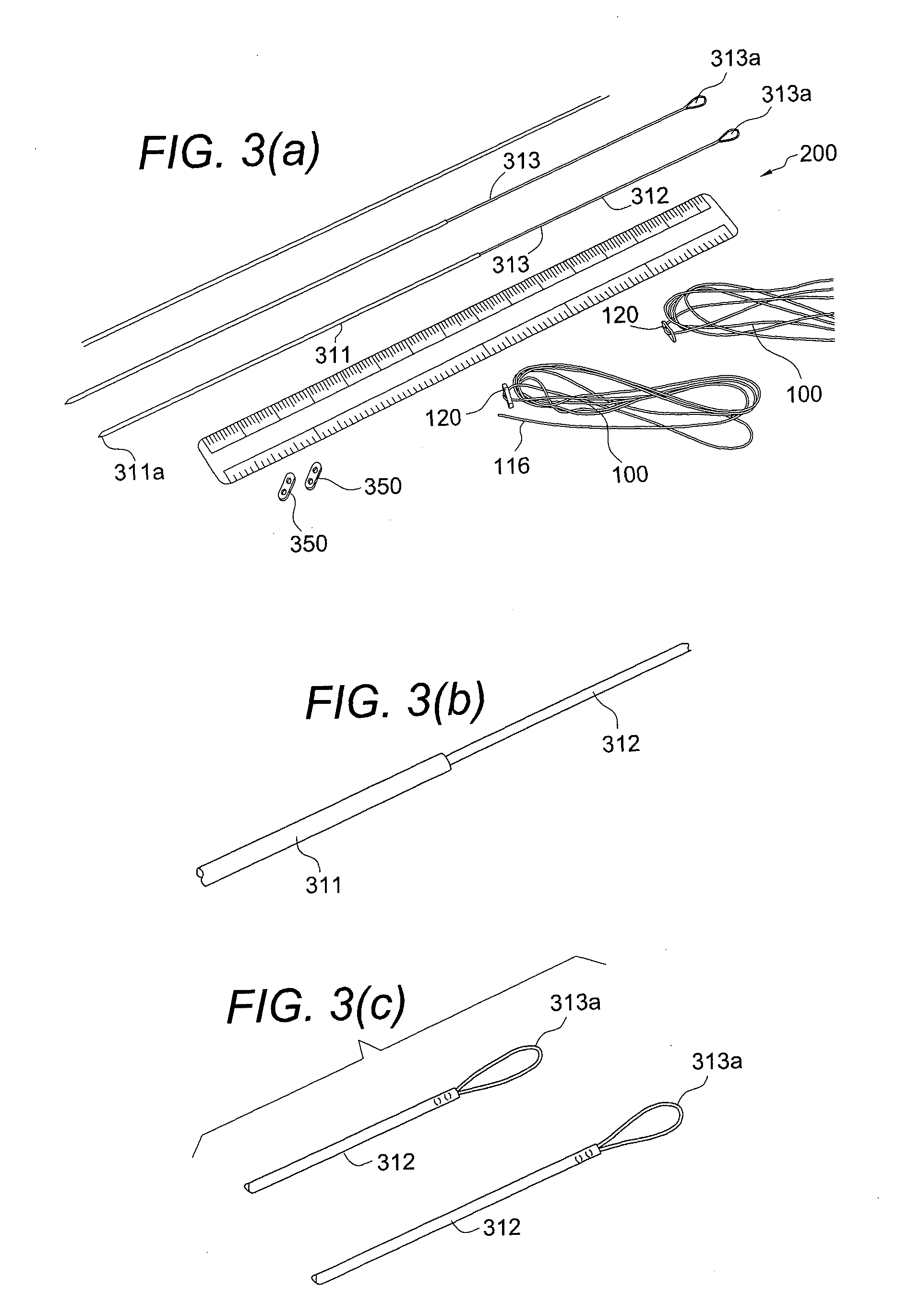 CMC repair using suture-button construct