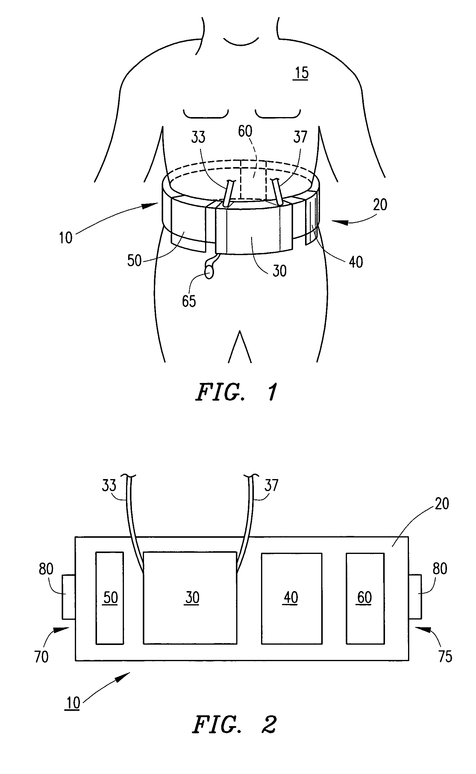 Wearable continuous renal replacement therapy device