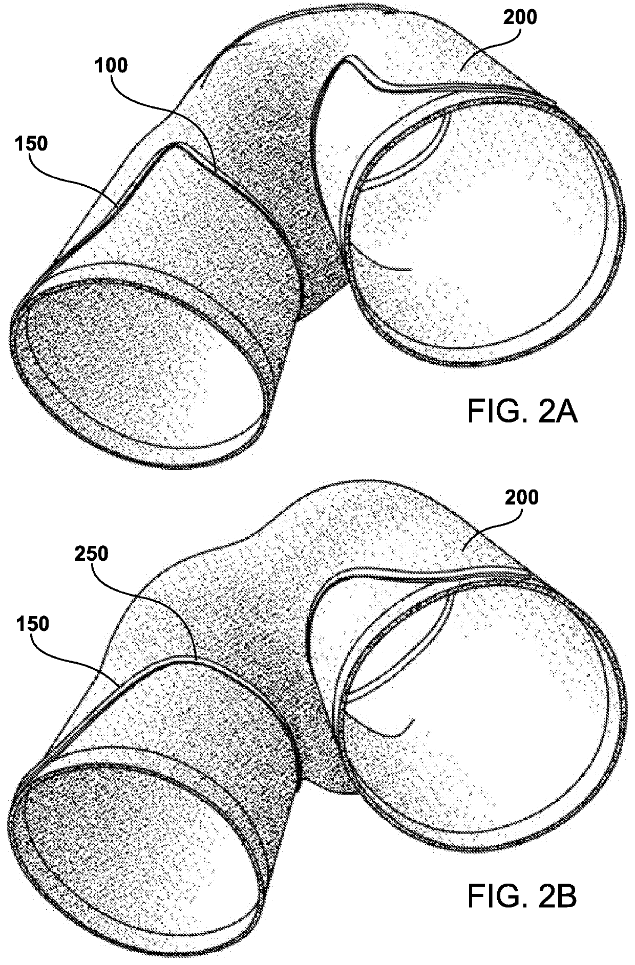 Undergarment that resists bunching