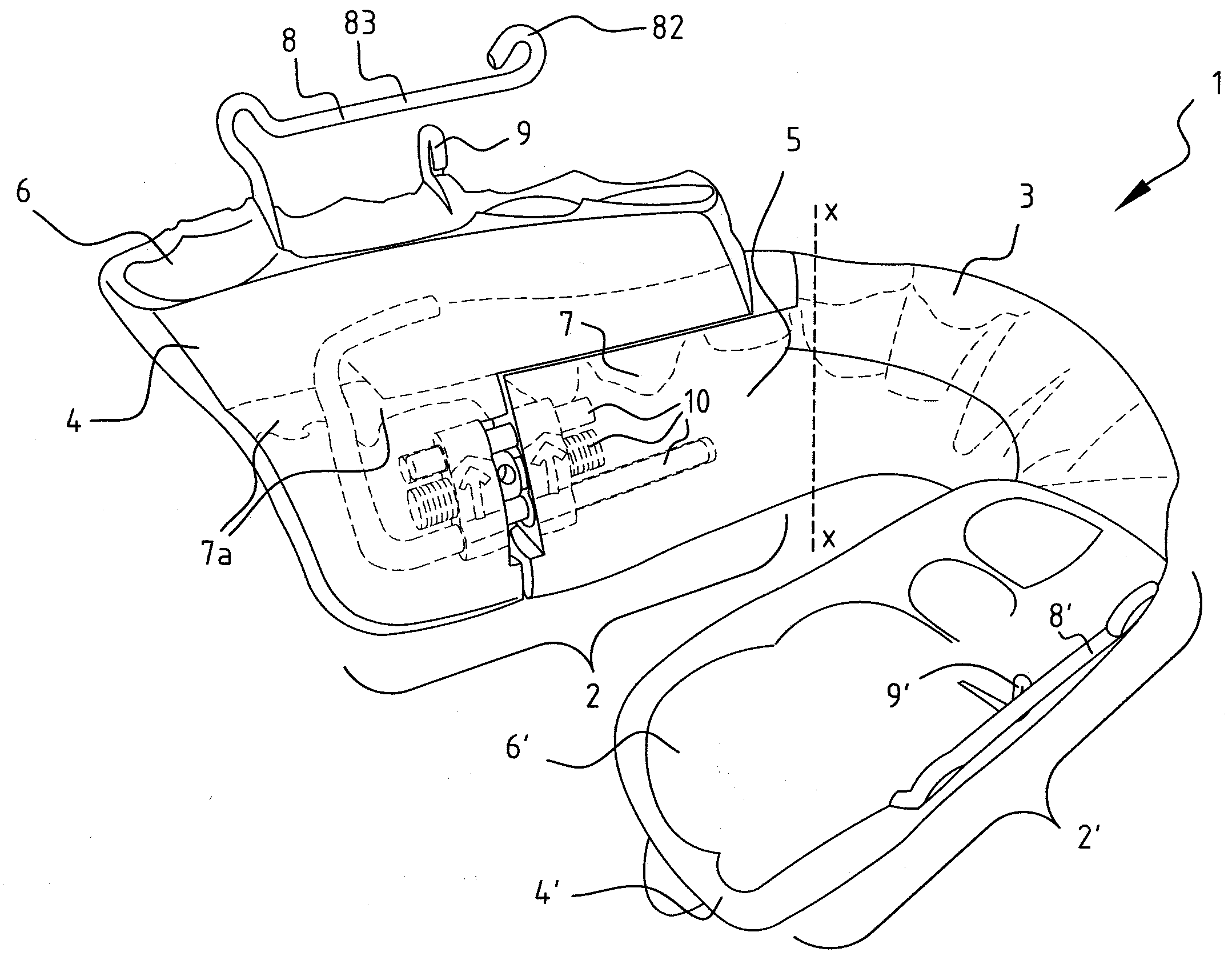 Orthodontic device