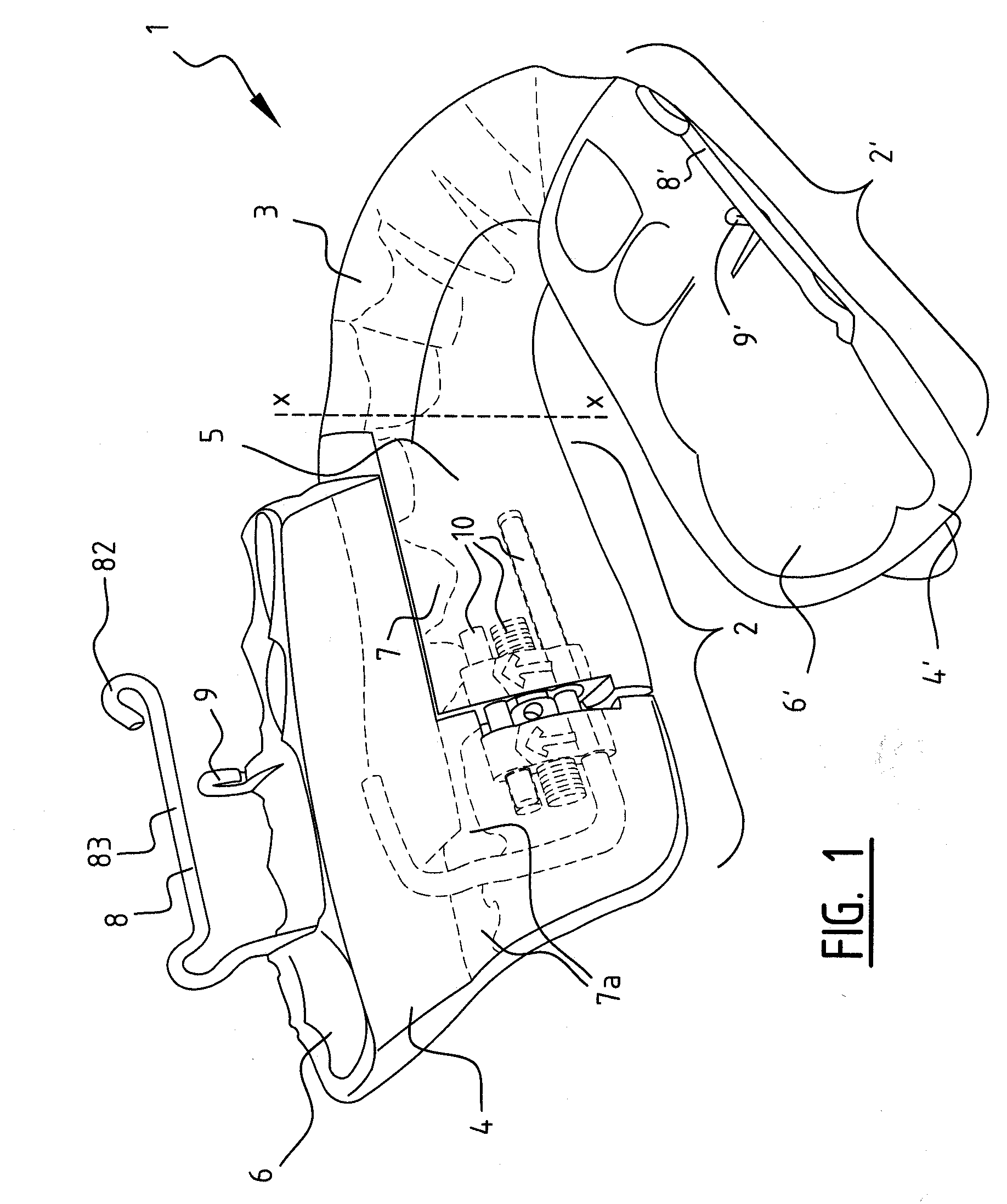 Orthodontic device