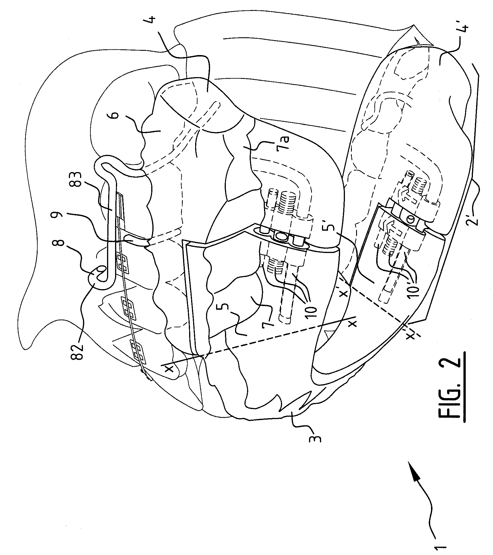 Orthodontic device