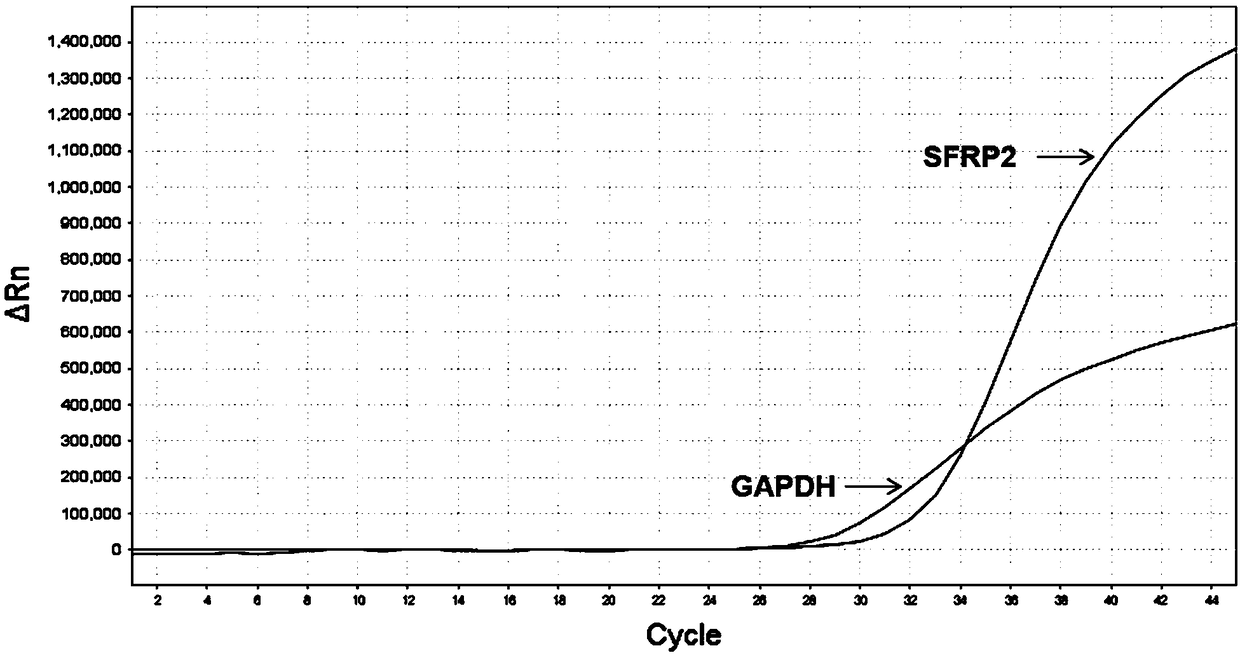 Primers, probes and kit used for human colorectal tumor specific methylation detection and application of primers and probes used for human colorectal tumor specific methylation detection