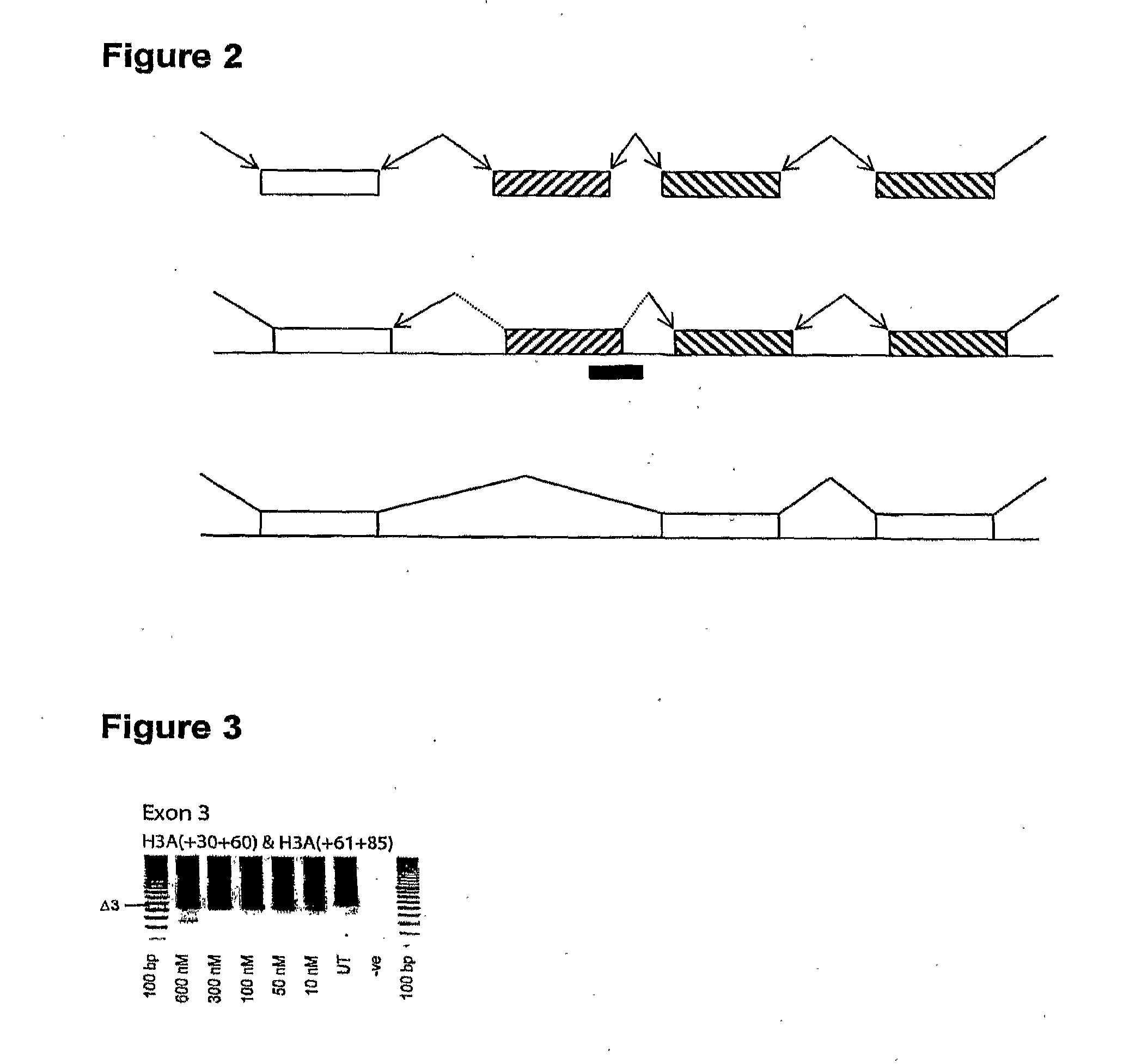 Antisense molecules and methods for treating pathologies