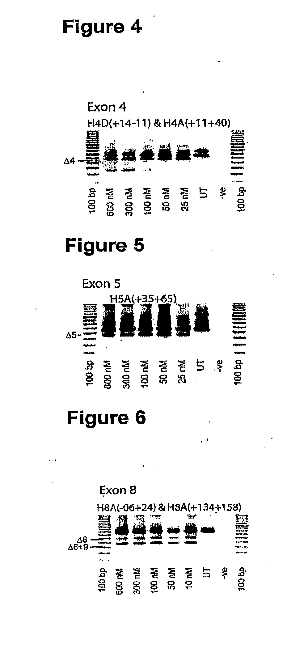 Antisense molecules and methods for treating pathologies