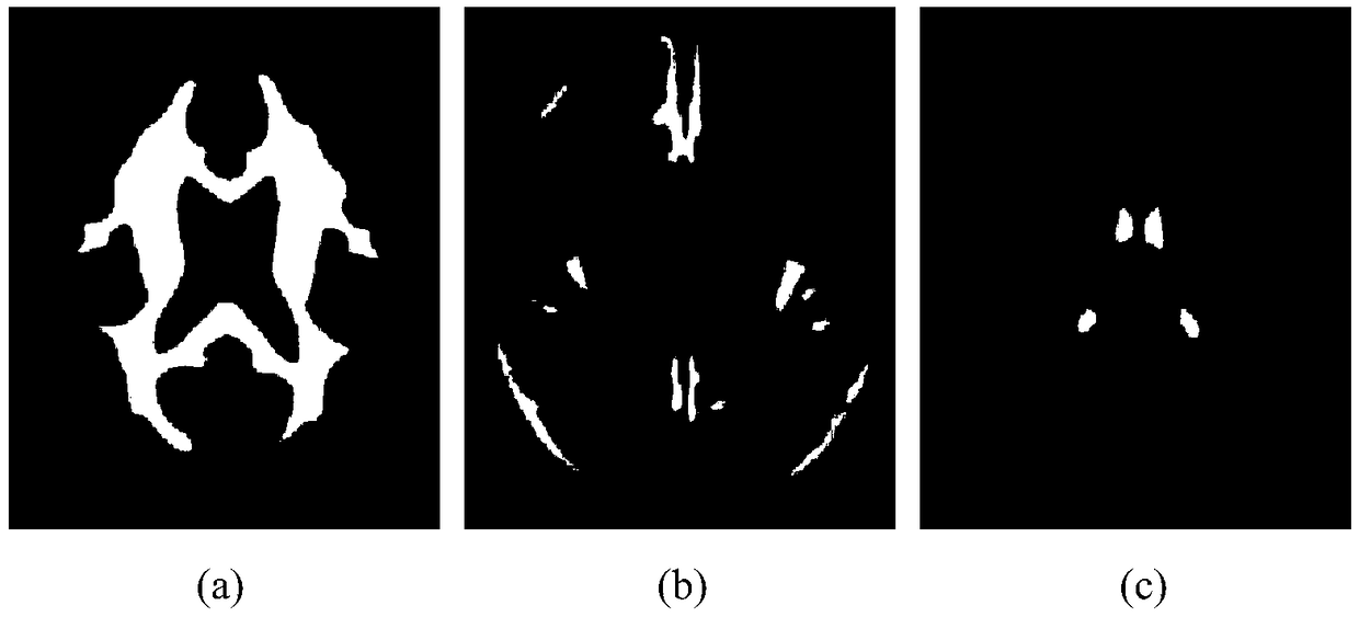 A brain tissue segmentation method based on regularized graph segmentation